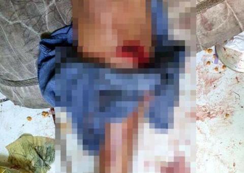 Mulher fica gravemente ferida após apanhar do marido em Manaus 