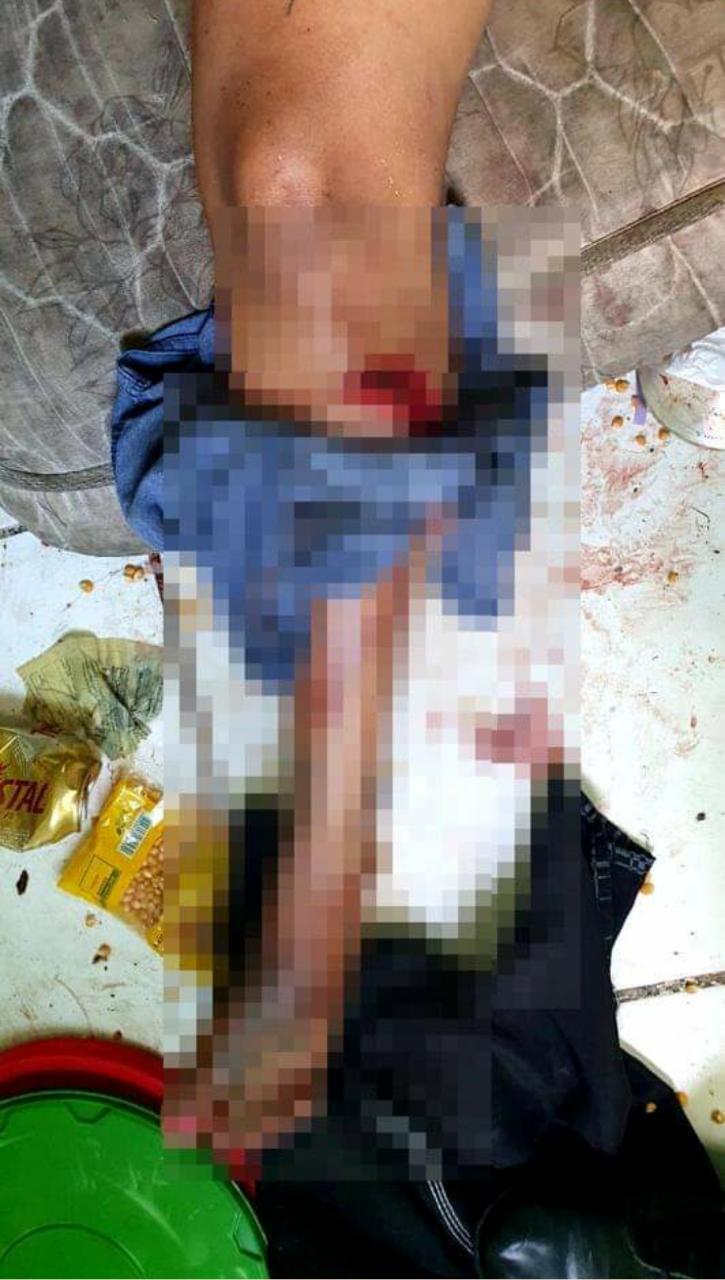 Mulher fica gravemente ferida após apanhar do marido em Manaus 