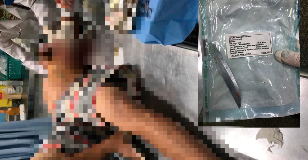 Homem é furado com faca durante banho em Manaus