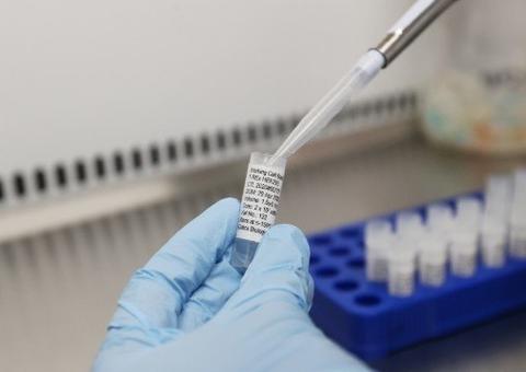 China alerta que Cazaquistão tem vírus mais mortal que Covid-19