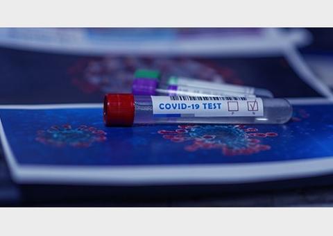Saiba como fazer o teste diagnóstico de covid-19 pelo plano de saúde