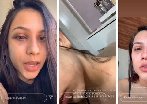 Filha de vereador denuncia ter sido espancada pelo pai: 'Monstro'