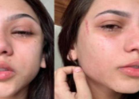 Polícia abre inquérito para investigar jovem que foi agredida por vereador 