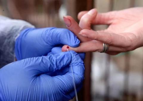 Justiça derruba liminar que obriga plano de saúde a cobrir teste de covid-19