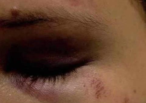 Mãe é agredida a socos após se negar a fazer comida para filha de 21 anos