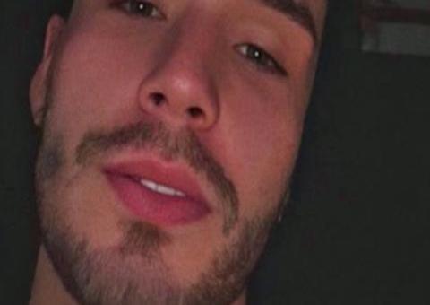 Ex-A Fazenda Lucas Viana passa por cirurgia no nariz e mostra resultado 