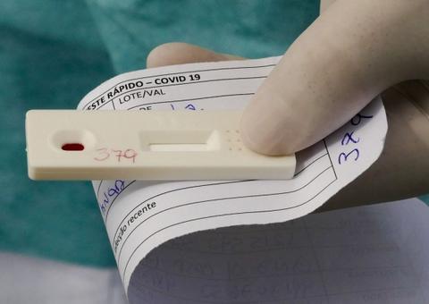 ANS retira teste para covid-19 de lista obrigatória de cobertura de planos de saúde