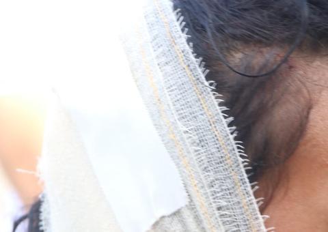 Mulher é espancada a pauladas pela família em briga por auxílio emergencial em Manaus