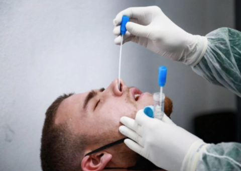 Chapecoense anuncia mais dez casos de covid-19 e totaliza 26