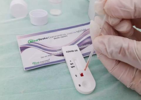 Amazonas registra mais 476 casos de Covid-19