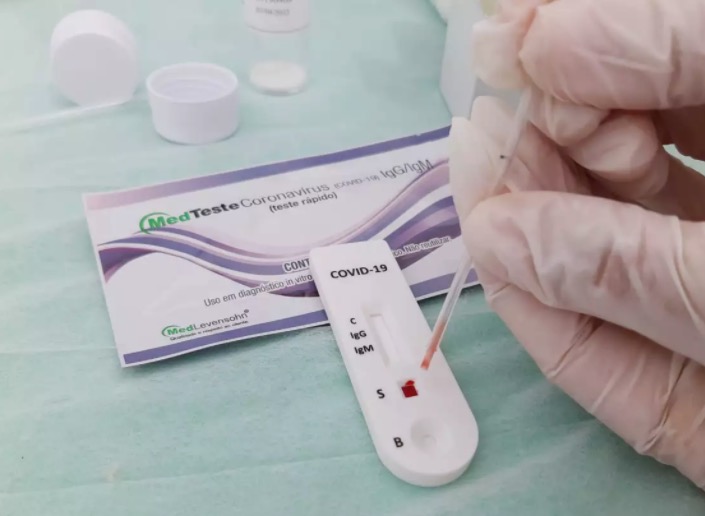 Amazonas registra mais 476 casos de Covid-19