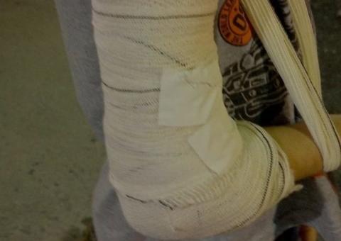 Mulher é espancada a pauladas ao tentar defender vizinha de agressão do marido 