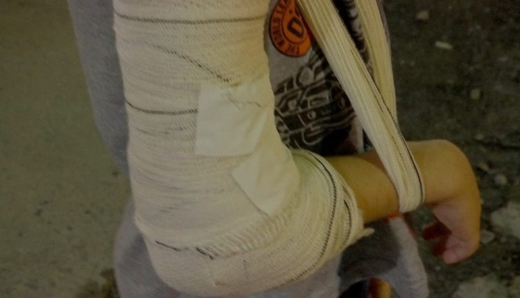 Mulher é espancada a pauladas ao tentar defender vizinha de agressão do marido 