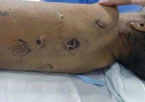 Criança é internada em estado grave após ser espancada pela mãe e padrasto