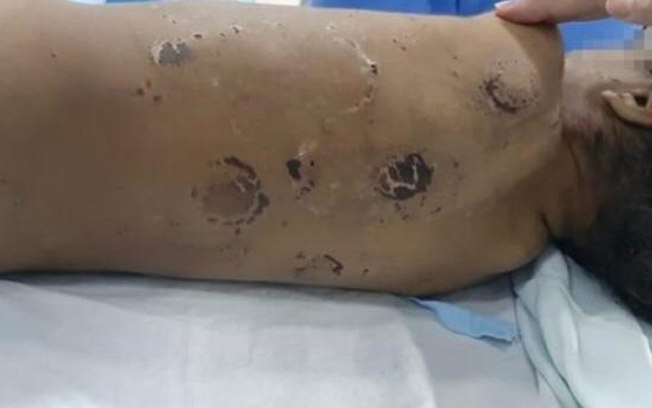 Criança é internada em estado grave após ser espancada pela mãe e padrasto