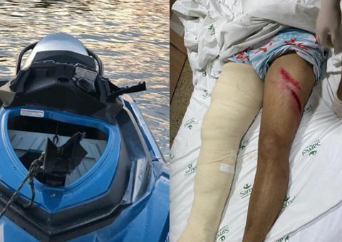 Josué Neto fraturou osso e sofreu lesões generalizadas em acidente com Jet Ski