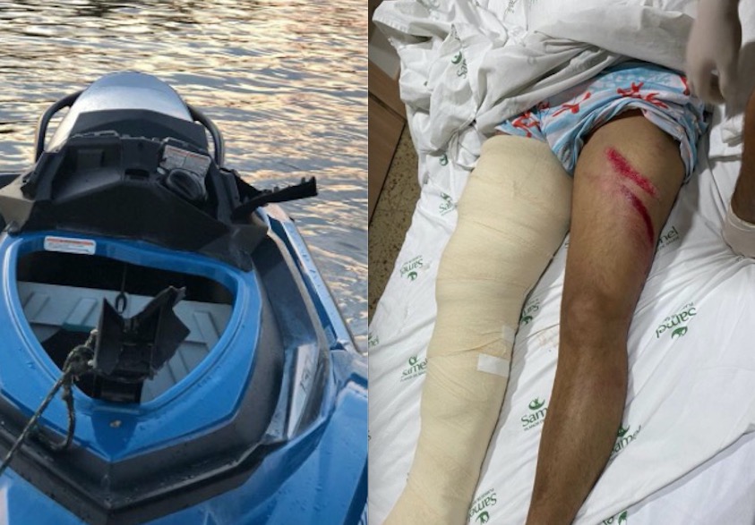 Josué Neto fraturou osso e sofreu lesões generalizadas em acidente com Jet Ski