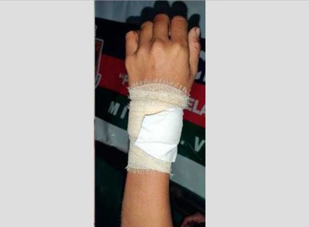 Durante briga no Amazonas, homem esfaqueia esposa e acaba morto por ela