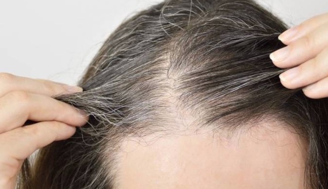 Veja dica rápida para quem pretende esconder os fios brancos