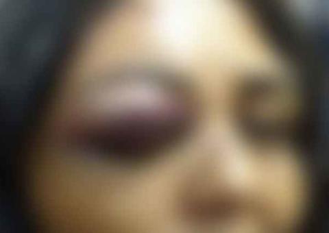 Marido dá ‘bicudas’ na cabeça de mulher ao flagrar ela dançar com outros homens em festa