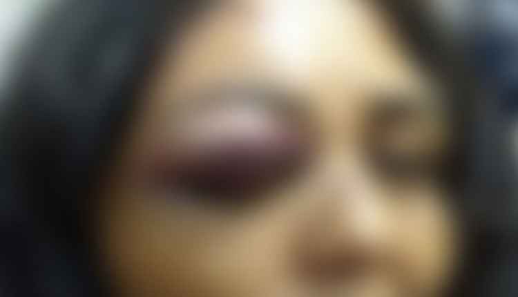 Marido dá ‘bicudas’ na cabeça de mulher ao flagrar ela dançar com outros homens em festa