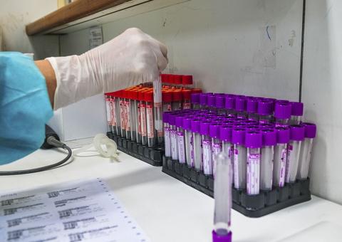 Trombose em pequenos vasos é característica de covid-19, diz estudo