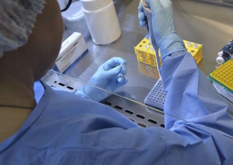 Saúde abre consulta sobre protocolo de transplante de rim