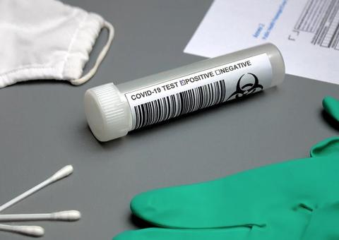 Hospital erra 36 resultados de teste da Covid-19 do Red Bull Bragantino