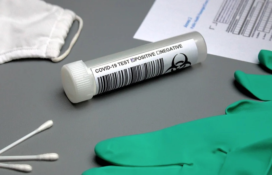 Hospital erra 36 resultados de teste da Covid-19 do Red Bull Bragantino