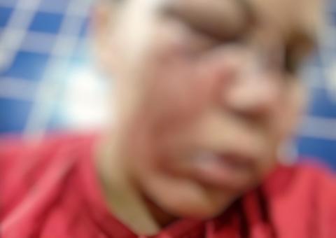 Cinegrafista da Record é suspeito de agredir com socos ex-mulher  