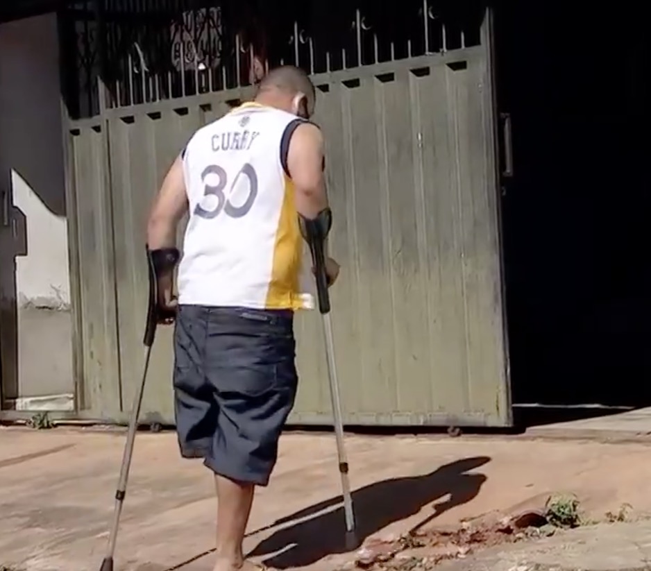 Recepcionista tem perna roubada e desabafa: 'quem fez isso não tem Deus'