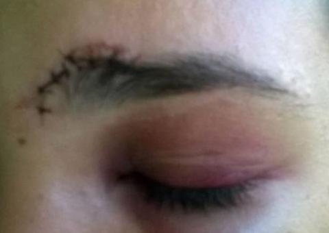 Após confraternização, mulher é espancada com golpes de madeira por marido