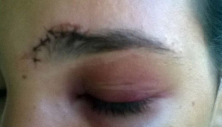 Após confraternização, mulher é espancada com golpes de madeira por marido