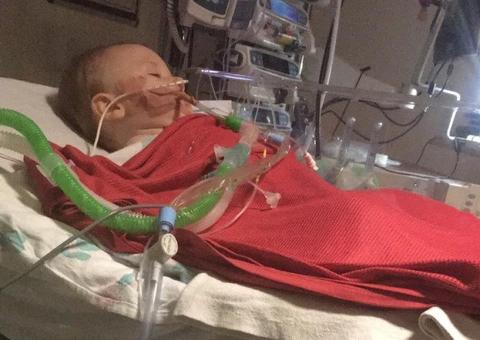 Bebê entra em coma após ingerir cápsula de detergente 