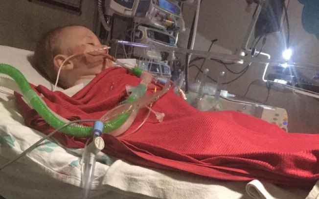 Bebê entra em coma após ingerir cápsula de detergente 