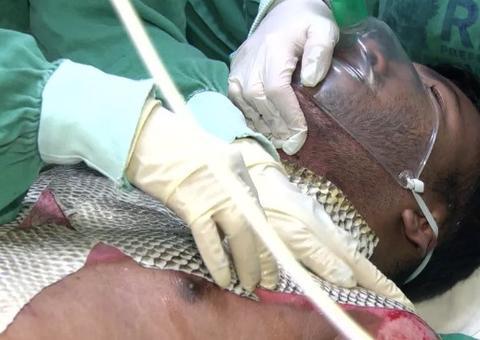 Brasileiros querem enviar pele de tilápia para tratar feridos em Beirute