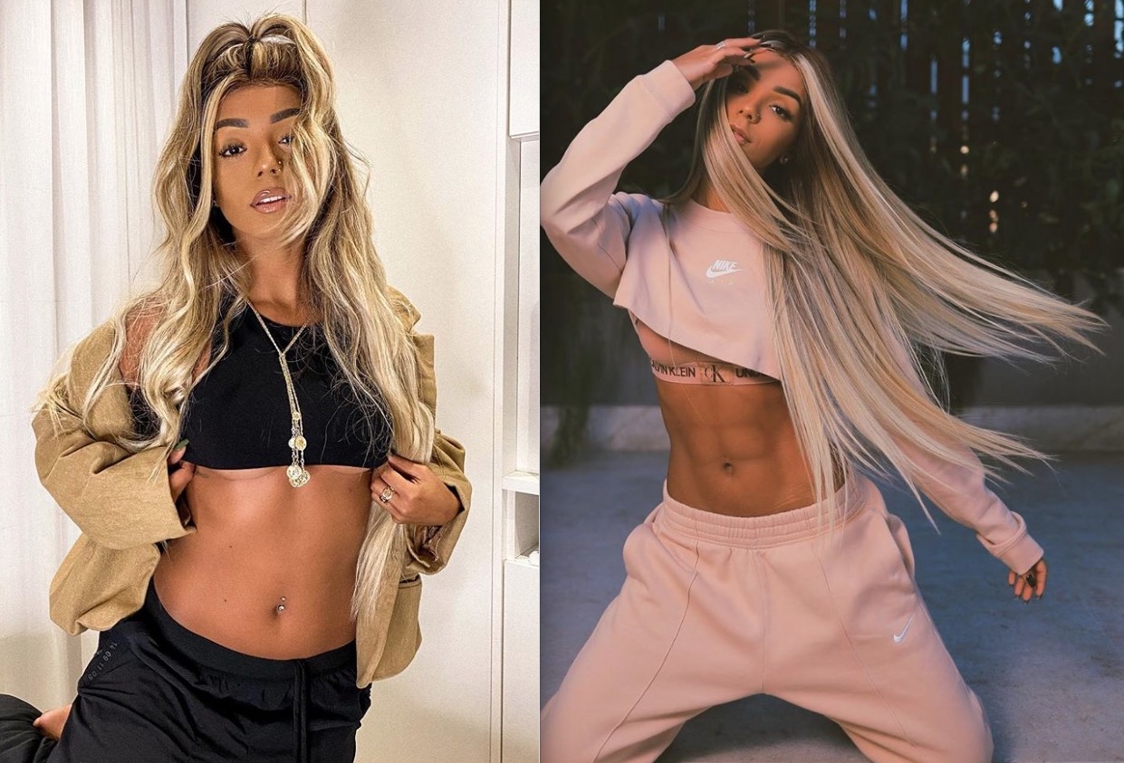 Esposa de Ludmilla exibe gominhos no abdômen após Lipo Lad