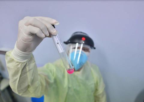 Coari ultrapassa 100 mortes por Covid-19