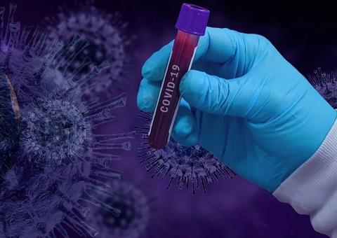 Interior do Amazonas tem 68.639 casos de coronavírus