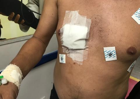 Passageiro é esfaqueado durante assalto a linha de ônibus 652 em Manaus