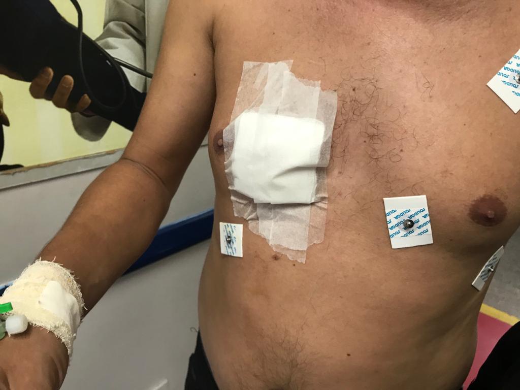 Passageiro é esfaqueado durante assalto a linha de ônibus 652 em Manaus