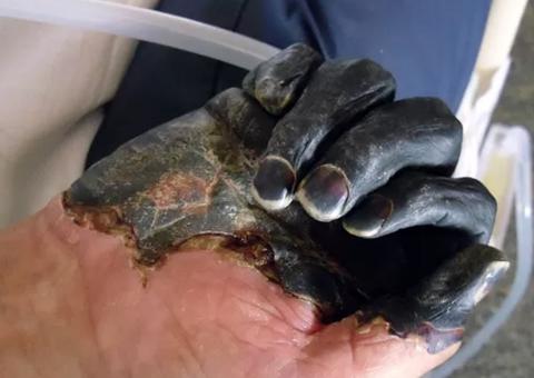 China isola vilarejo após morte de morador por peste bubônica