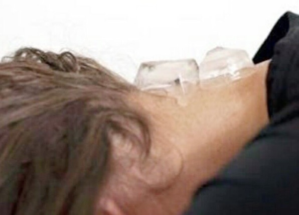 Saiba o que acontece com o corpo quando se coloca gelo na nuca