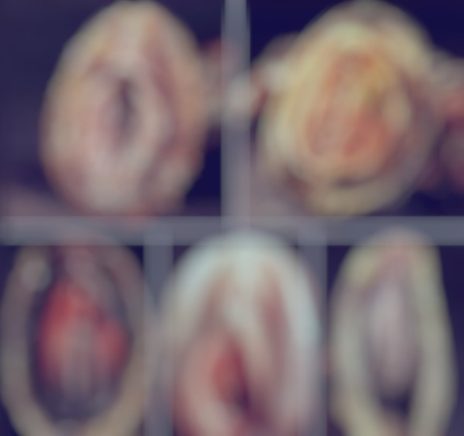 Saiba a verdade sobre mexilhões com formato de vagina