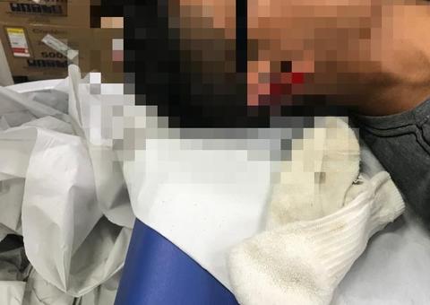 Jovem tem parte de orelha arrancada após ser baleado por assaltantes em Manaus