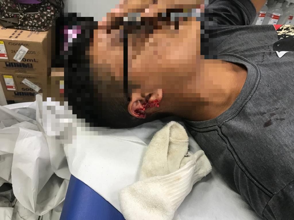 Jovem tem parte de orelha arrancada após ser baleado por assaltantes em Manaus