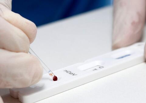 Brasil registra 106.523 mortes e 3,27 milhões de casos de Covid; Saiba mais