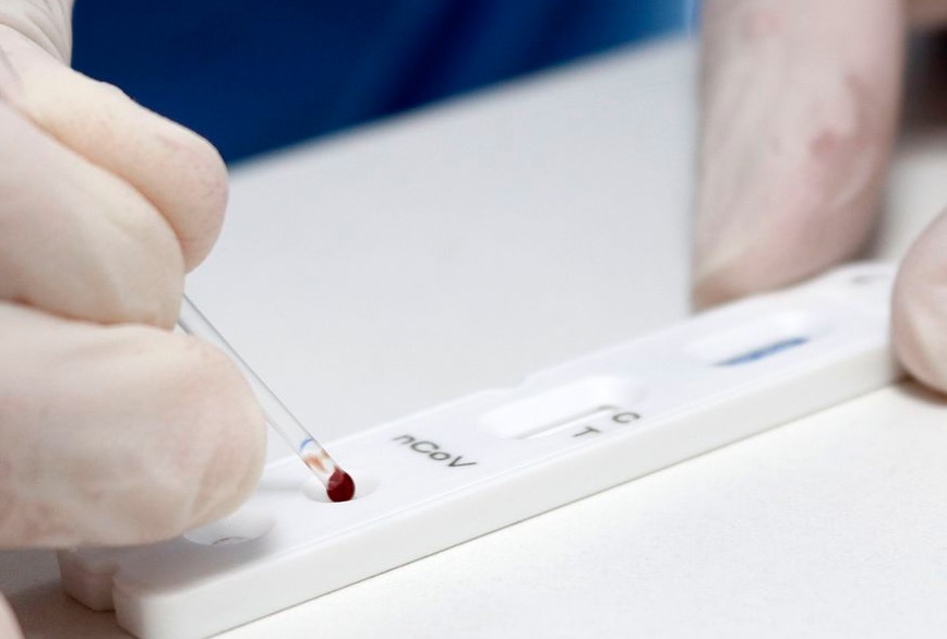 Brasil registra 106.523 mortes e 3,27 milhões de casos de Covid; Saiba mais