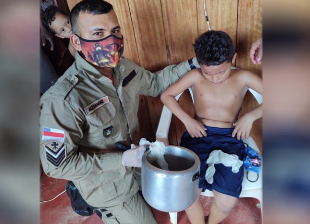 Criança entra em desespero ao ficar com cabeça presa em panela no Amazonas