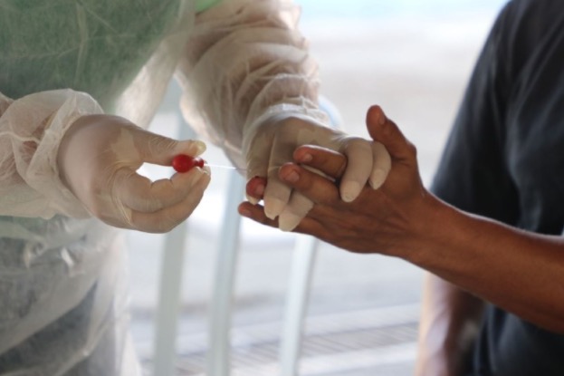 Professores e servidores podem agendar teste rápido para Covid-19 em Manaus